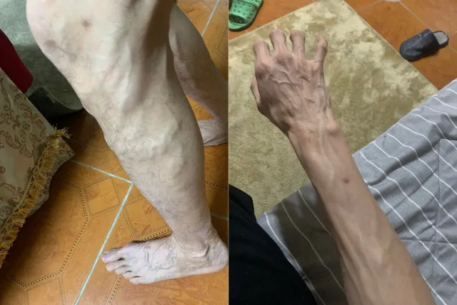 Lao động Việt Nam tại Hàn Quốc kêu cứu vì không thể đổi nơi làm việc dù sức khỏe suy giảm nghiêm trọng